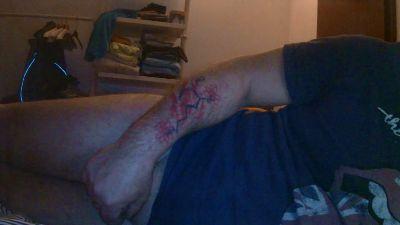 AleMe