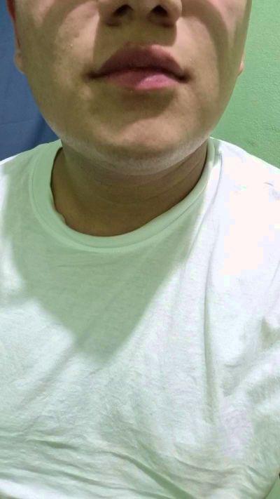 Aleazu