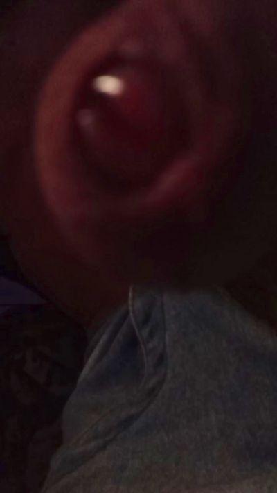 FimosePikaGG