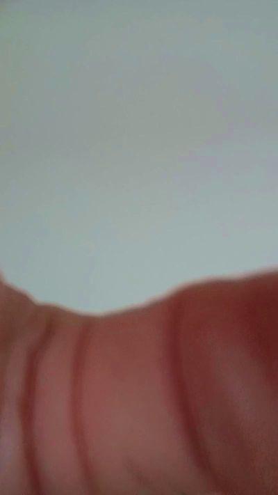 Isdykeslinas