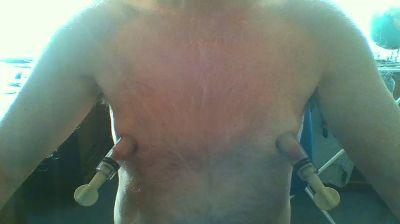Nippeltrimm
