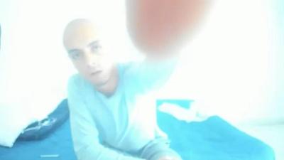 SkinHeadx