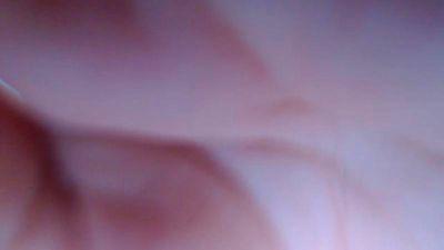 dimple17
