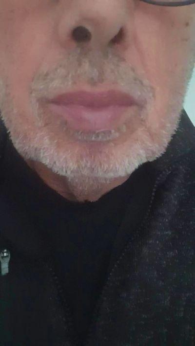 nicluna