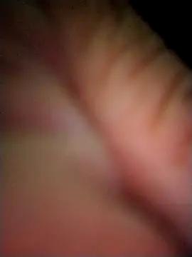Ficose